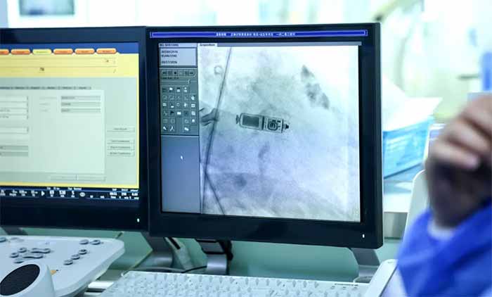 <b>�ޡ��ߡ��������ġ�ϣ�� | ��Ժ�ɹ���չ����˫ǻ�޵�����������ֲ������</b>